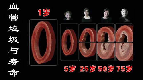 养生课 养生